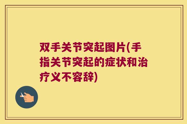 双手关节突起图片(手指关节突起的症状和义不容辞) 双手关节突起图片(手指关节突起的症状和义不容辞)