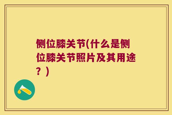 侧位膝关节(什么是侧位膝关节照片及其用途？)