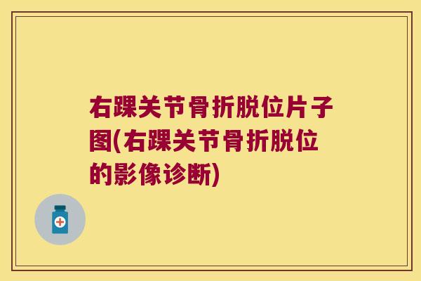 右踝关节脱位片子图(右踝关节脱位的影像诊断) 右踝关节脱位片子图(右踝关节脱位的影像诊断)
