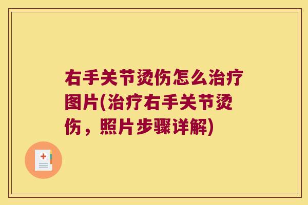 右手关节烫伤怎么图片(右手关节烫伤，照片步骤详解)