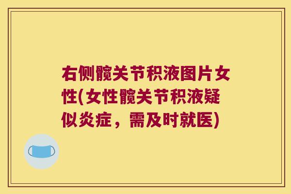 右侧髋关节积液图片女性(女性髋关节积液疑似,需及时就医) 右侧髋关节积液图片女性(女性髋关节积液疑似,需及时就医)