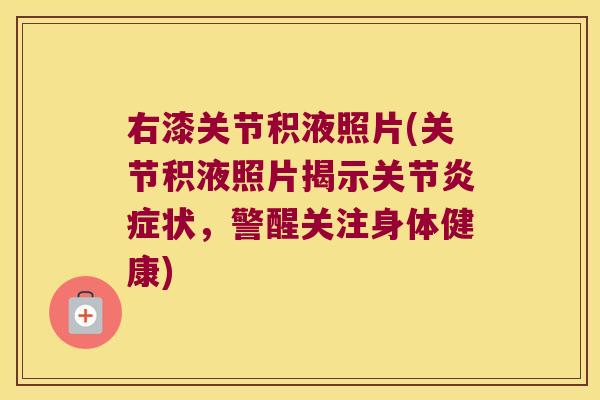 右漆关节积液照片(关节积液照片揭示关节状，警醒关注身体健康)