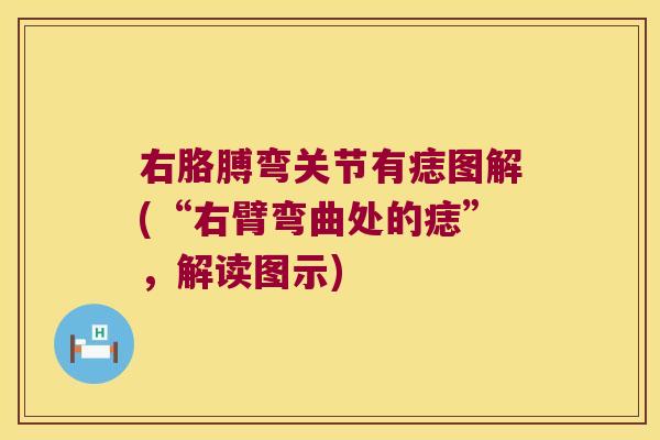 右胳膊弯关节有痣图解(“右臂弯曲处的痣”，解读图示)