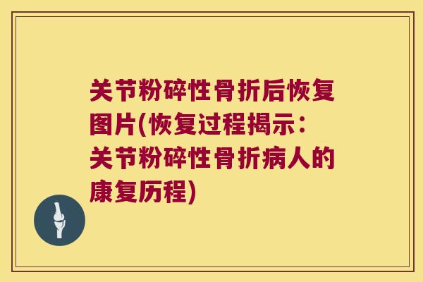 关节粉碎性后恢复图片(恢复过程揭示:关节粉碎性人的康复历程) 关节粉碎性后恢复图片(恢复过程揭示:关节粉碎性人的康复历程)