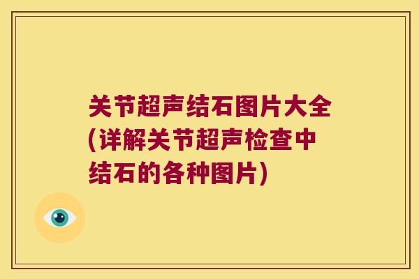 关节超声结石图片大全(详解关节超声检查中结石的各种图片)