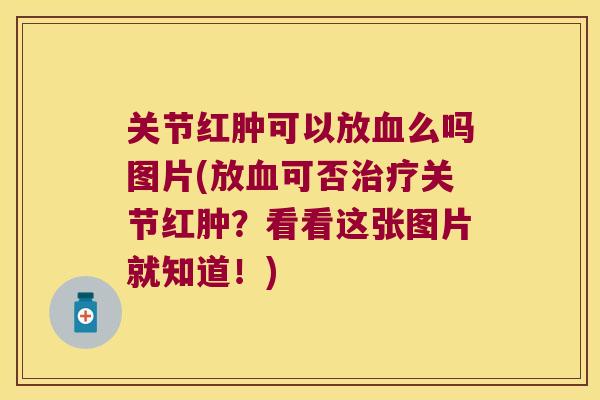 关节红肿可以放么吗图片(放可否关节红肿？看看这张图片就知道！)