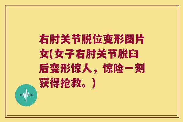 右肘关节脱位变形图片女(女子右肘关节脱臼后变形惊人，惊险一刻获得抢救。)