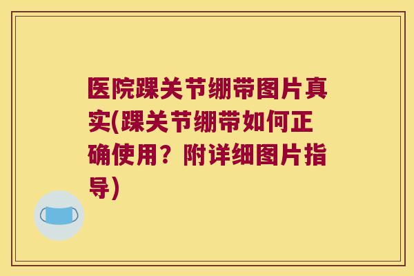医院踝关节绷带图片真实(踝关节绷带如何正确使用?附详细图片指导) 医院踝关节绷带图片真实(踝关节绷带如何正确使用?附详细图片指导)