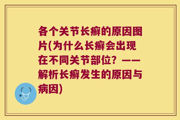 各个关节长癣的原因图片(为什么长癣会出现在不同关节部位？——解析长癣发生的原因与因)