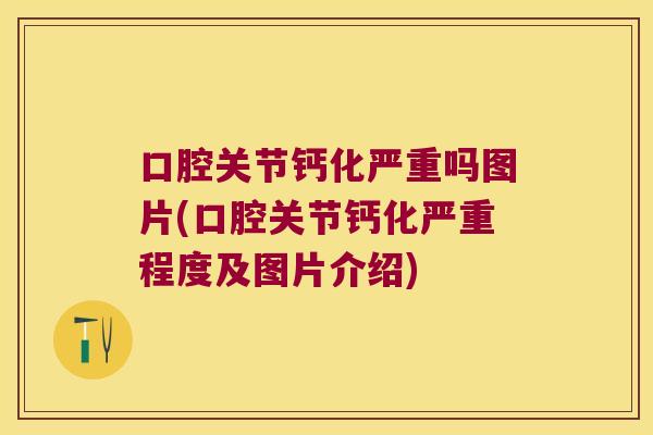 口腔关节钙化严重吗图片(口腔关节钙化严重程度及图片介绍)