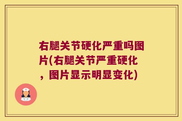 右腿关节硬化严重吗图片(右腿关节严重硬化,图片显示明显变化) 右腿关节硬化严重吗图片(右腿关节严重硬化,图片显示明显变化)