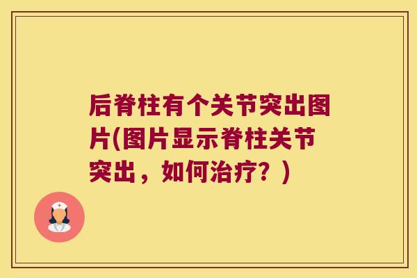 后脊柱有个关节突出图片(图片显示脊柱关节突出,如何?) 后脊柱有个关节突出图片(图片显示脊柱关节突出,如何?)