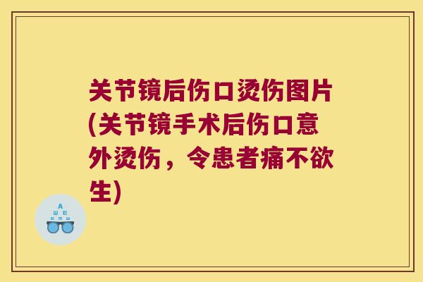 关节镜后伤口烫伤图片(关节镜手术后伤口意外烫伤,令患者痛不欲生) 关节镜后伤口烫伤图片(关节镜手术后伤口意外烫伤,令患者痛不欲生)