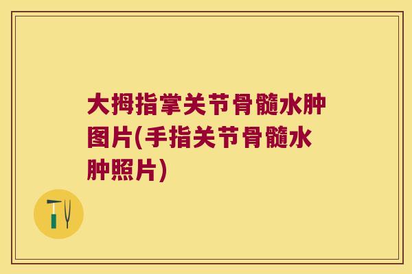 大拇指掌关节骨髓水肿图片(手指关节骨髓水肿照片) 大拇指掌关节骨髓水肿图片(手指关节骨髓水肿照片)