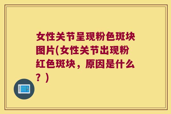 女性关节呈现粉色斑块图片(女性关节出现粉红色斑块，原因是什么？)