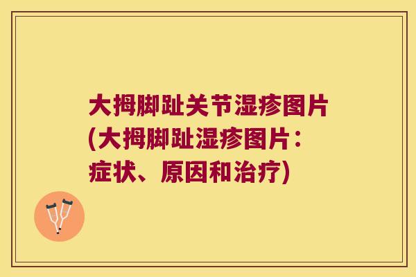 大拇脚趾关节图片(大拇脚趾图片：症状、原因和)