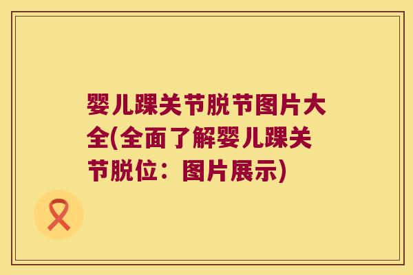 婴儿踝关节脱节图片大全(全面了解婴儿踝关节脱位:图片展示) 婴儿踝关节脱节图片大全(全面了解婴儿踝关节脱位:图片展示)