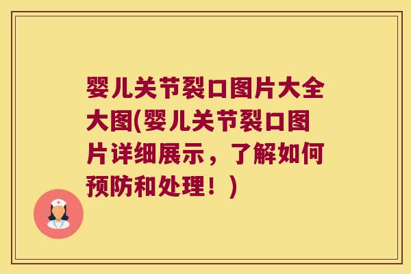 婴儿关节裂口图片大全大图(婴儿关节裂口图片详细展示，了解如何和处理！)