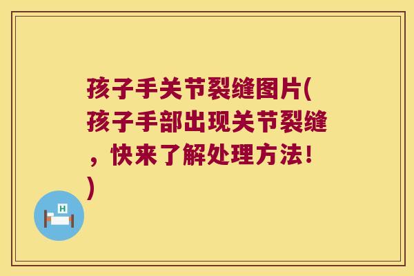 孩子手关节裂缝图片(孩子手部出现关节裂缝,快来了解处理方法!) 孩子手关节裂缝图片(孩子手部出现关节裂缝,快来了解处理方法!)