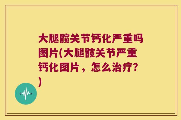大腿髋关节钙化严重吗图片(大腿髋关节严重钙化图片，怎么？)