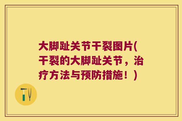 大脚趾关节干裂图片(干裂的大脚趾关节,方法与措施!) 大脚趾关节干裂图片(干裂的大脚趾关节,方法与措施!)