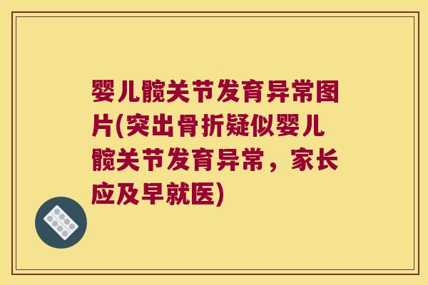 婴儿髋关节发育异常图片(突出疑似婴儿髋关节发育异常,家长应及早就医) 婴儿髋关节发育异常图片(突出疑似婴儿髋关节发育异常,家长应及早就医)