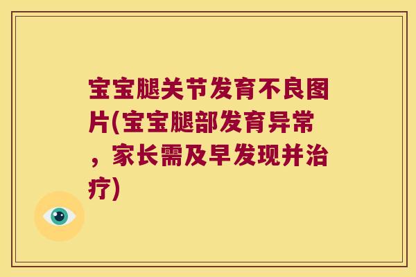 宝宝腿关节发育不良图片(宝宝腿部发育异常,家长需及早发现并) 宝宝腿关节发育不良图片(宝宝腿部发育异常,家长需及早发现并)