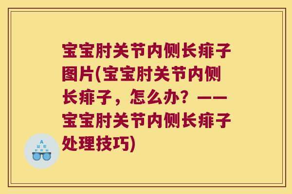 宝宝肘关节内侧长痱子图片(宝宝肘关节内侧长痱子,怎么办?——宝宝肘关节内侧长痱子处理技巧) 宝宝肘关节内侧长痱子图片(宝宝肘关节内侧长痱子,怎么办?——宝宝肘关节内侧长痱子处理技巧)