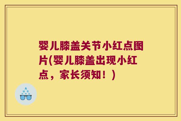 婴儿膝盖关节小红点图片(婴儿膝盖出现小红点,家长须知!) 婴儿膝盖关节小红点图片(婴儿膝盖出现小红点,家长须知!)