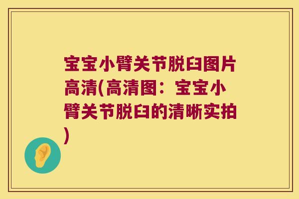 宝宝小臂关节脱臼图片高清(高清图:宝宝小臂关节脱臼的清晰实拍) 宝宝小臂关节脱臼图片高清(高清图:宝宝小臂关节脱臼的清晰实拍)