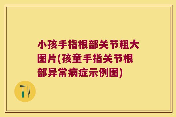 小孩手指根部关节粗大图片(孩童手指关节根部异常症示例图)