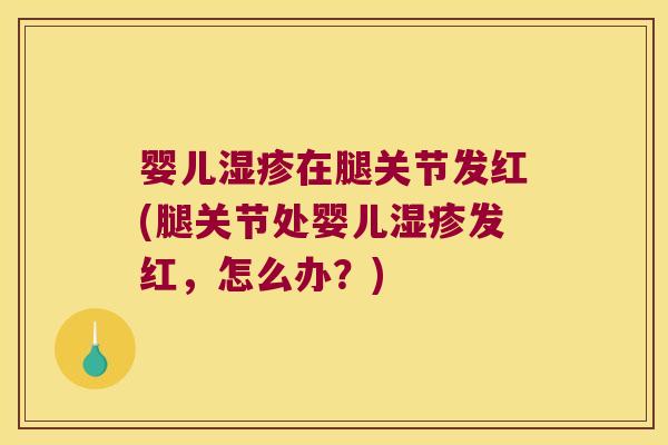 婴儿在腿关节发红(腿关节处婴儿发红,怎么办?) 婴儿在腿关节发红(腿关节处婴儿发红,怎么办?)