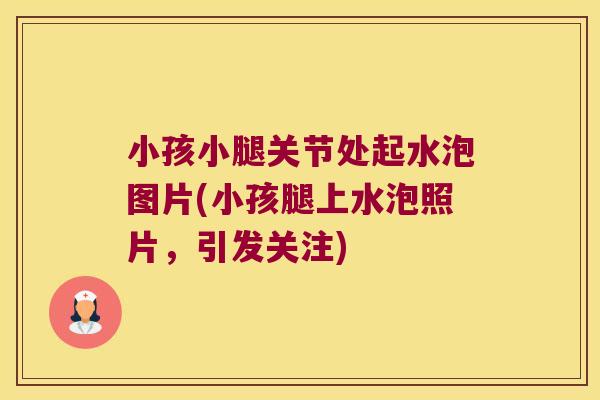 小孩小腿关节处起水泡图片(小孩腿上水泡照片,引发关注) 小孩小腿关节处起水泡图片(小孩腿上水泡照片,引发关注)