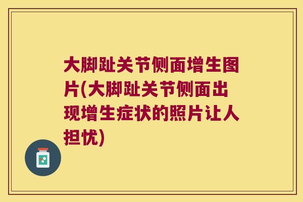 大脚趾关节侧面增生图片(大脚趾关节侧面出现增生症状的照片让人担忧)