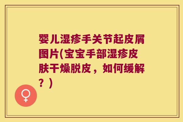 婴儿手关节起皮屑图片(宝宝手部干燥脱皮，如何缓解？)