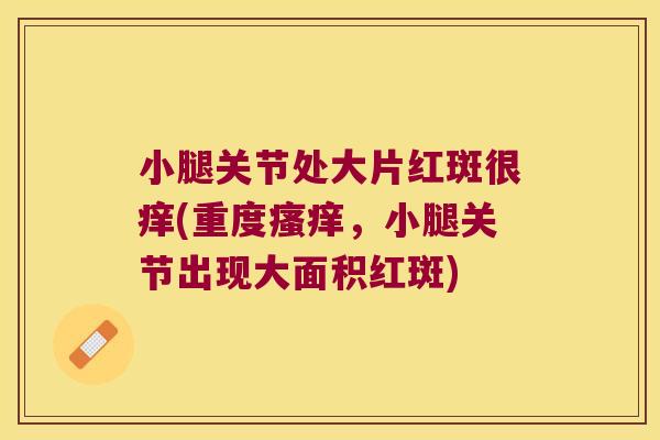 小腿关节处大片红斑很痒(重度,小腿关节出现大面积红斑) 小腿关节处大片红斑很痒(重度,小腿关节出现大面积红斑)