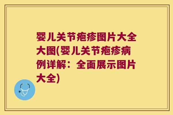 婴儿关节疱疹图片大全大图(婴儿关节疱疹例详解:全面展示图片大全) 婴儿关节疱疹图片大全大图(婴儿关节疱疹例详解:全面展示图片大全)