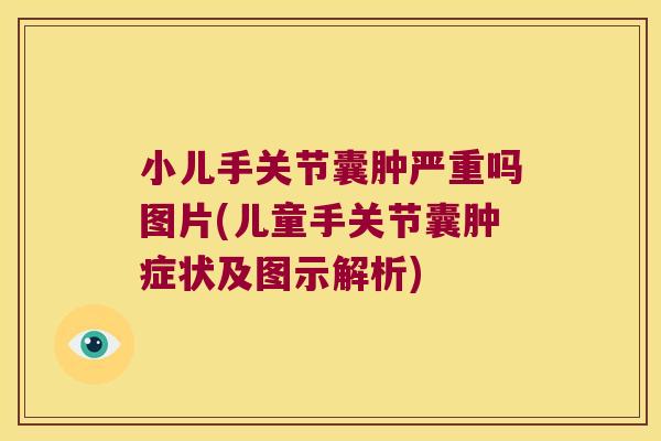 小儿手关节囊肿严重吗图片(儿童手关节囊肿症状及图示解析)