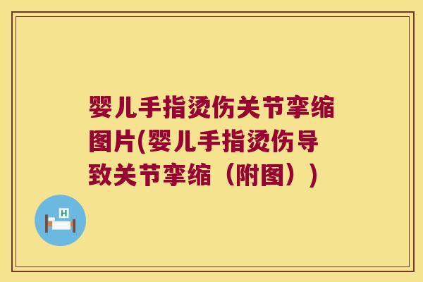 婴儿手指烫伤关节挛缩图片(婴儿手指烫伤导致关节挛缩(附图)) 婴儿手指烫伤关节挛缩图片(婴儿手指烫伤导致关节挛缩(附图))