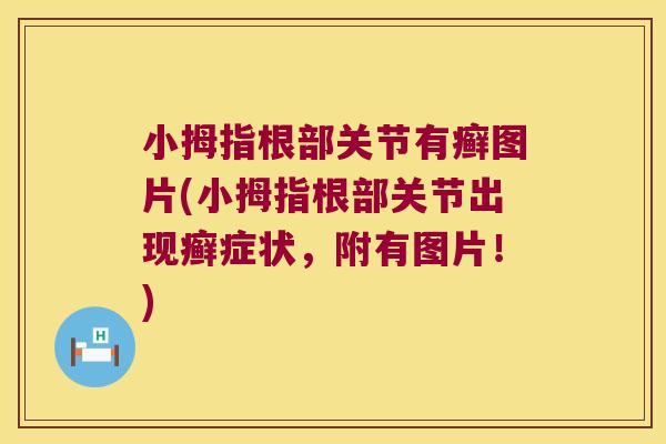 小拇指根部关节有癣图片(小拇指根部关节出现癣症状,附有图片!) 小拇指根部关节有癣图片(小拇指根部关节出现癣症状,附有图片!)