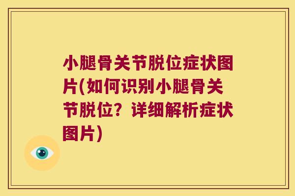 小腿骨关节脱位症状图片(如何识别小腿骨关节脱位？详细解析症状图片)
