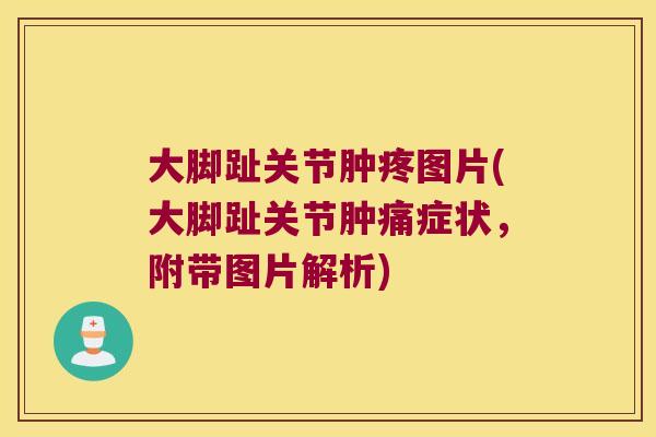 大脚趾关节肿疼图片(大脚趾关节肿痛症状，附带图片解析)