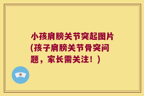 小孩肩膀关节突起图片(孩子肩膀关节骨突问题，家长需关注！)