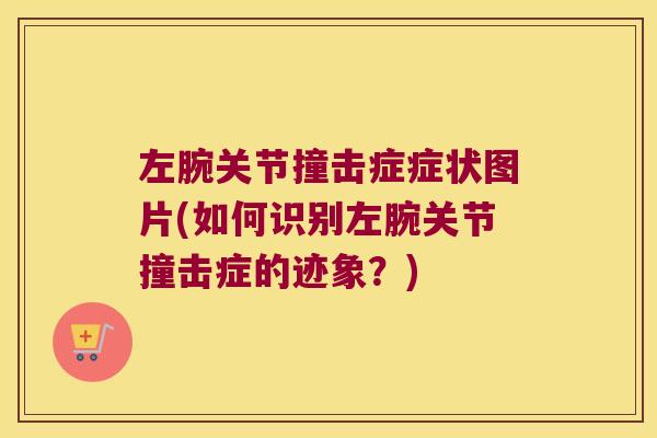 左腕关节撞击症症状图片(如何识别左腕关节撞击症的迹象?) 左腕关节撞击症症状图片(如何识别左腕关节撞击症的迹象?)