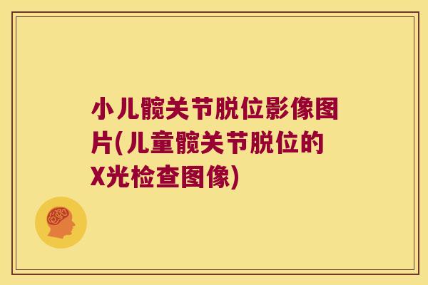 小儿髋关节脱位影像图片(儿童髋关节脱位的X光检查图像) 小儿髋关节脱位影像图片(儿童髋关节脱位的X光检查图像)