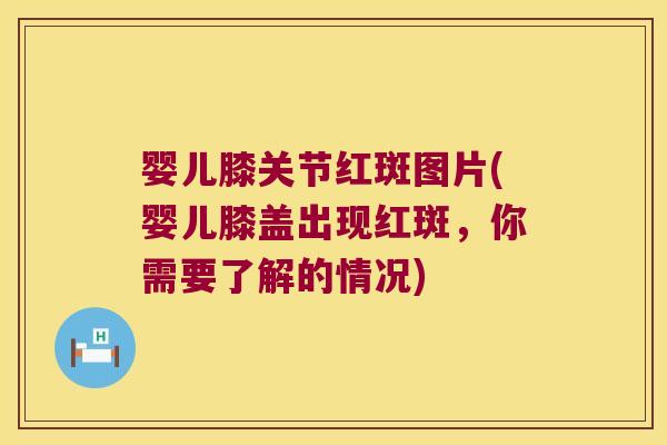 婴儿膝关节红斑图片(婴儿膝盖出现红斑，你需要了解的情况)