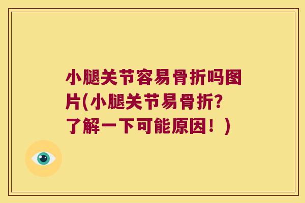 小腿关节容易吗图片(小腿关节易?了解一下可能原因!) 小腿关节容易吗图片(小腿关节易?了解一下可能原因!)