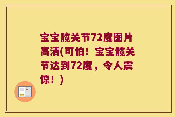 宝宝髋关节72度图片高清(可怕！宝宝髋关节达到72度，令人震惊！)