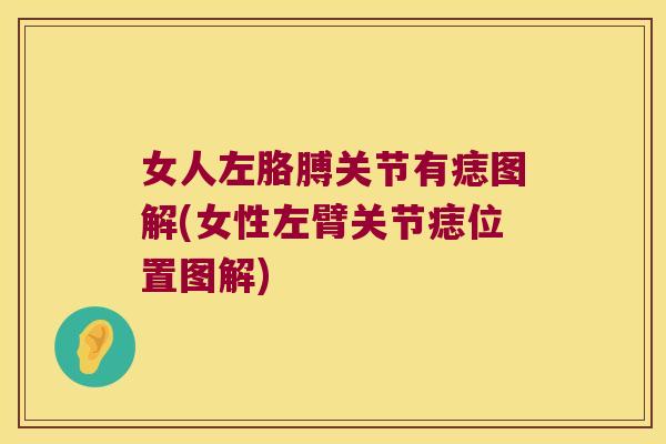 女人左胳膊关节有痣图解(女性左臂关节痣位置图解) 女人左胳膊关节有痣图解(女性左臂关节痣位置图解)