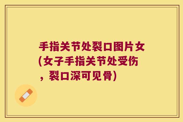 手指关节处裂口图片女(女子手指关节处受伤,裂口深可见骨) 手指关节处裂口图片女(女子手指关节处受伤,裂口深可见骨)